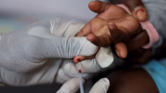 HIV (News Central TV)