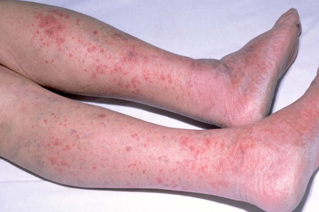 34 Die in Sokoto Meningitis Outbreak (News Central TV)
