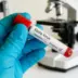 DR Congo's Locals Link Ebola to Witchcraft (News Central TV)