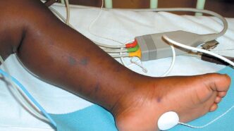34 Die in Sokoto Meningitis Outbreak (News Central TV)