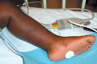 34 Die in Sokoto Meningitis Outbreak (News Central TV)