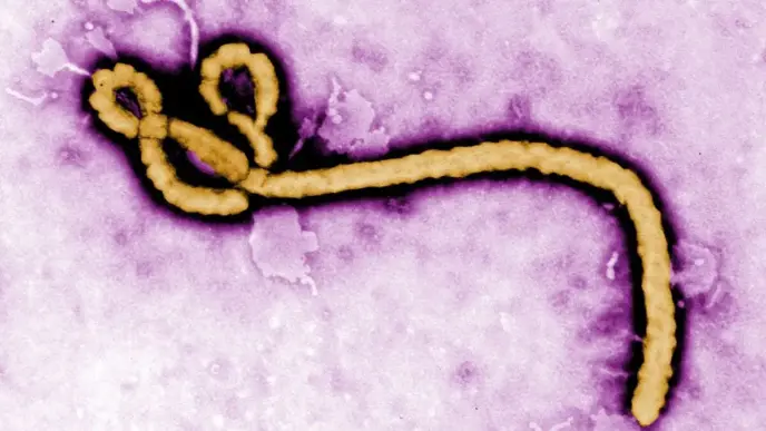 Why Ebola Outbreak in Africa Draws Global Attention
