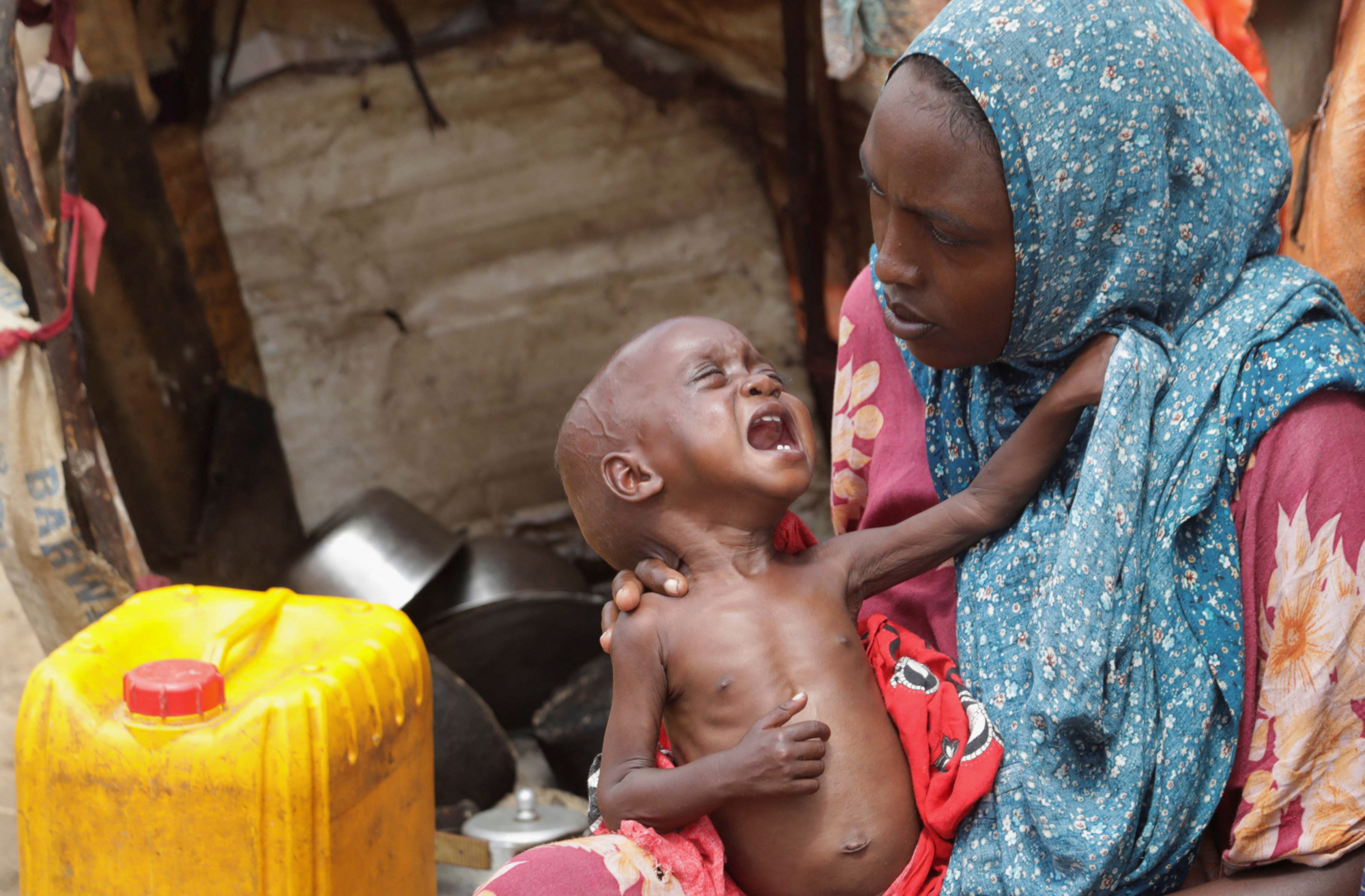 Somalia malnutrition funding drops over 80 per cent (News Central TV)