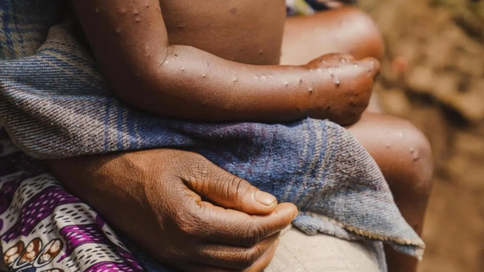 Guinea-Bissau faces first mpox outbreak (News Central TV)