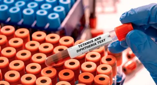Kano, Seven States Record 98% of Diphtheria Cases (NewsCentral TV)_