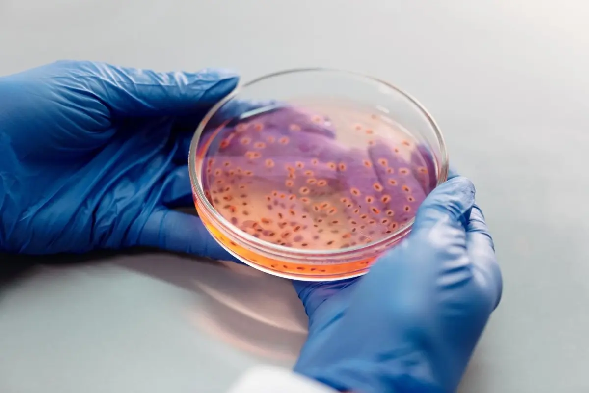 Salmonella outbreak at Mexican hospital