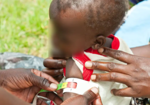 Uganda Children Face Rising Malnutrition Crisis (News Central TV) (1)