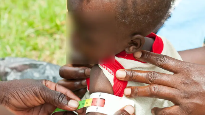 Uganda Children Face Rising Malnutrition Crisis (News Central TV) (1)