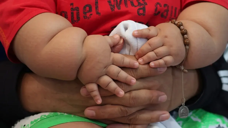 WHO Says No Obesity Drugs, Surgery for Under-10s