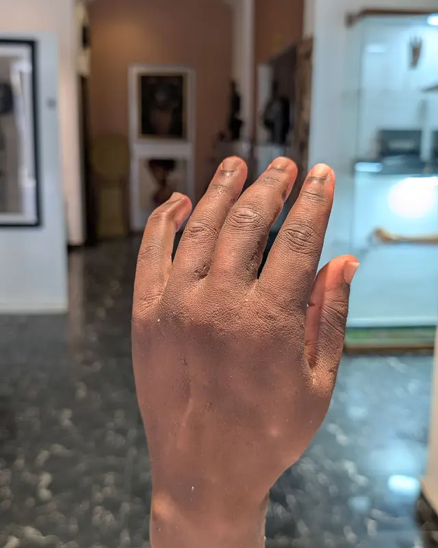 Nigerian Bionic Arm Named Among TIME’s Best Inventions (NewsCentral TV)1