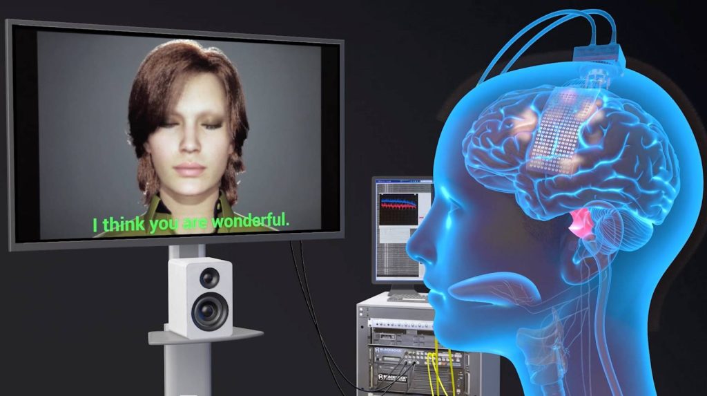 Breakthrough Brain Implant Translates Thoughts into Speech Instantly