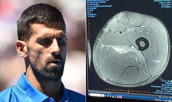 Djokovic Shares Injury Scan to Silence Critics After Australian Open Exit