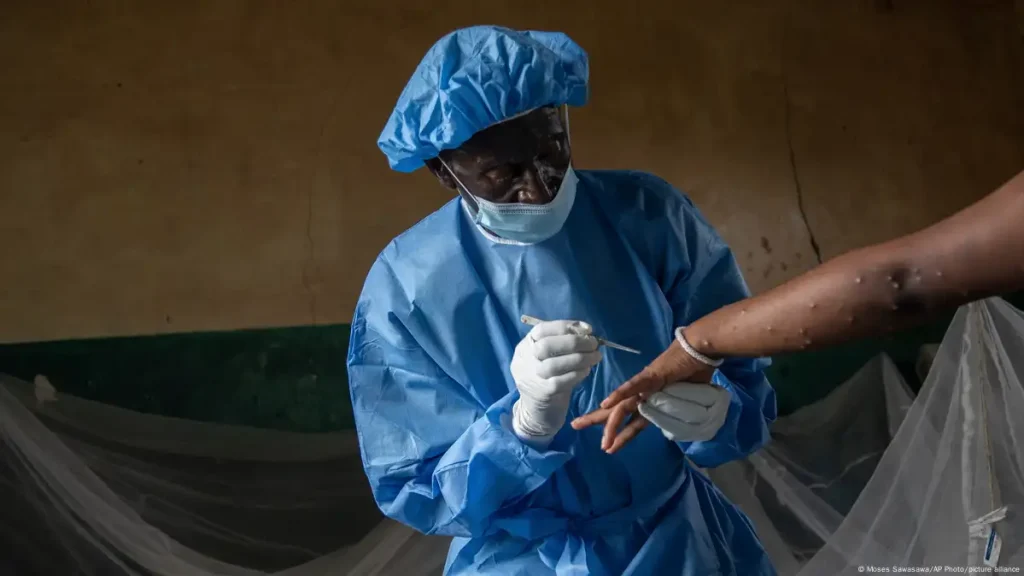 Health Workers in Sierra Leone Face Rising Mpox Infections