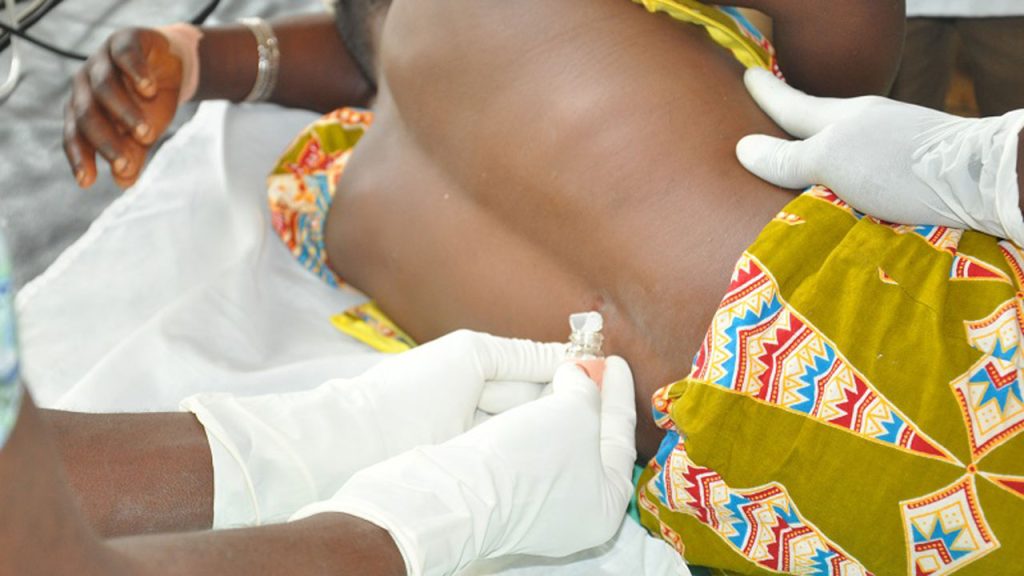 Meningitis Claims 190 Lives in 2023, NCDC Reports