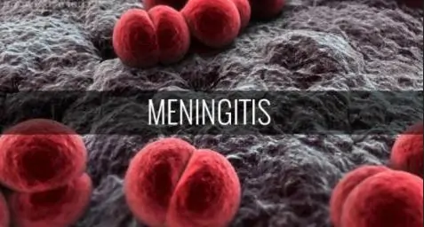 Meningitis Outbreak: 20 confirmed cases, no deaths recorded in Ghana