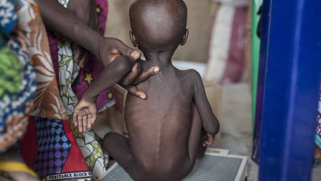 Nigeria Ranks Second Globally for Child Malnutrition- UNICEF(News Central TV)