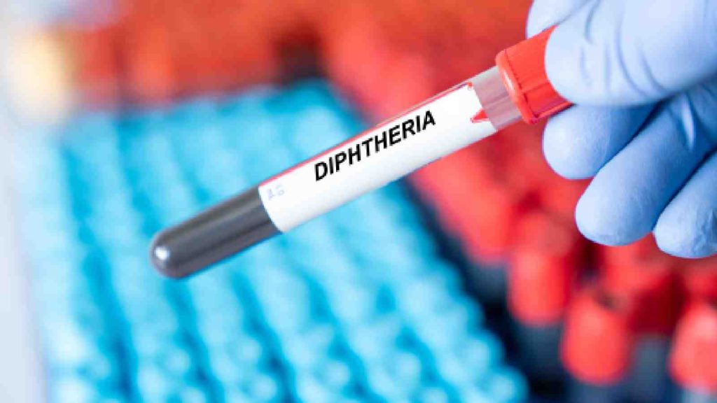 Nigeria's Edo State Records Two Diphtheria Deaths in Eight Months