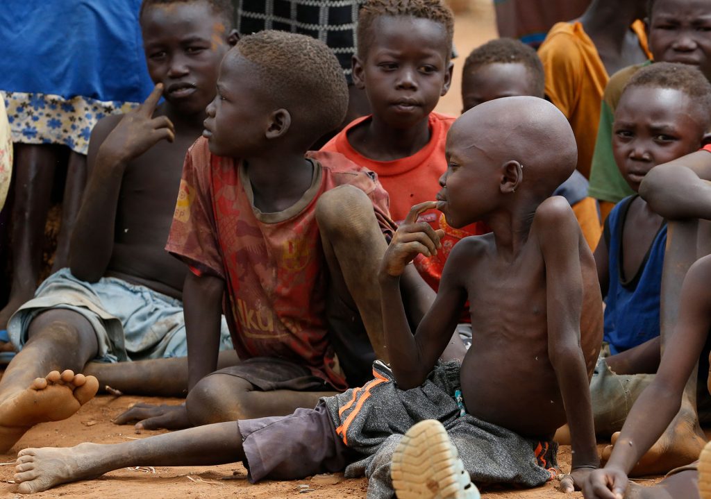 Sudan’s Malnourished Children Struggle, Aid Blockades Worsen