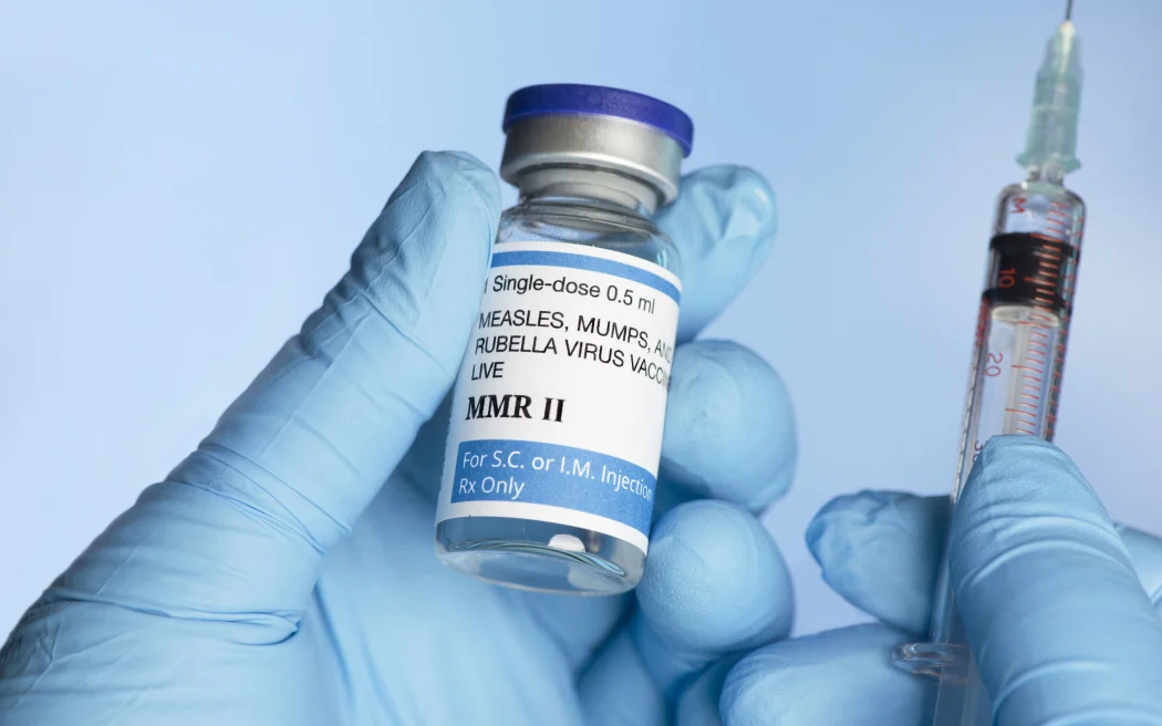 Measles Vaccine. 