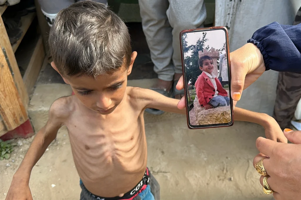 UNRWA Accuses Israel of Starving Gaza Civilians