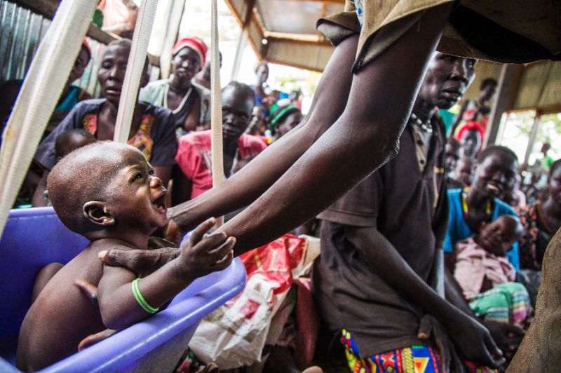 US Aid Cuts Blamed for Child Deaths in South Sudan