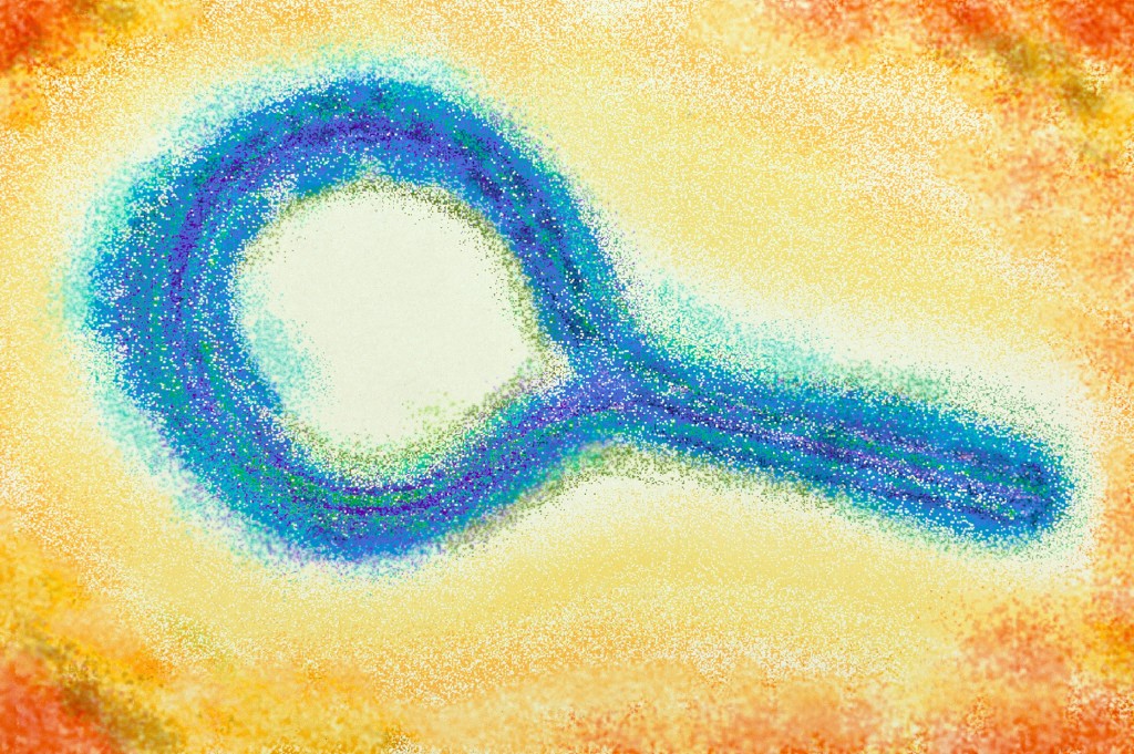 Uganda Commences Clinical Trial for Sudan Strain of Ebola Vaccine