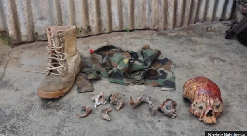 Uganda Self-Proclaimed Healer Caught with 24 Human Skulls(News Central Tv)