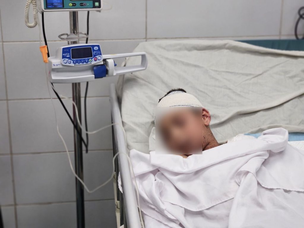Child, 10, Who Lost Nine Siblings to Israeli Bombing Heads to Italy for Treatment